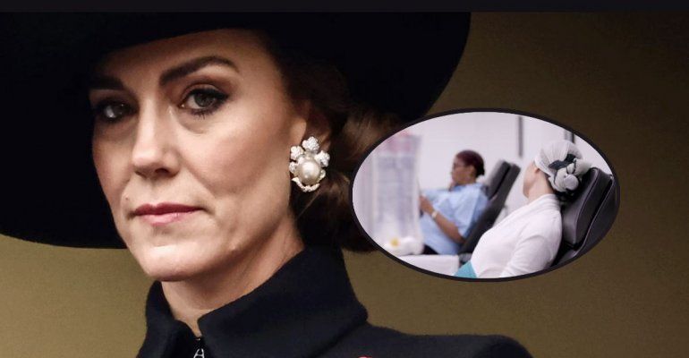 Kate Middleton: cos’è la chemioterapia preventiva a cui si sottopone