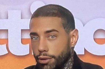 Dopo Francesco Chiofalo arriva lui: impazza la moda degli interventi estetici estremi